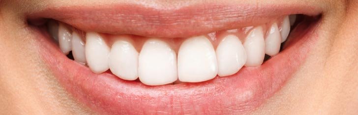 After smile treatment